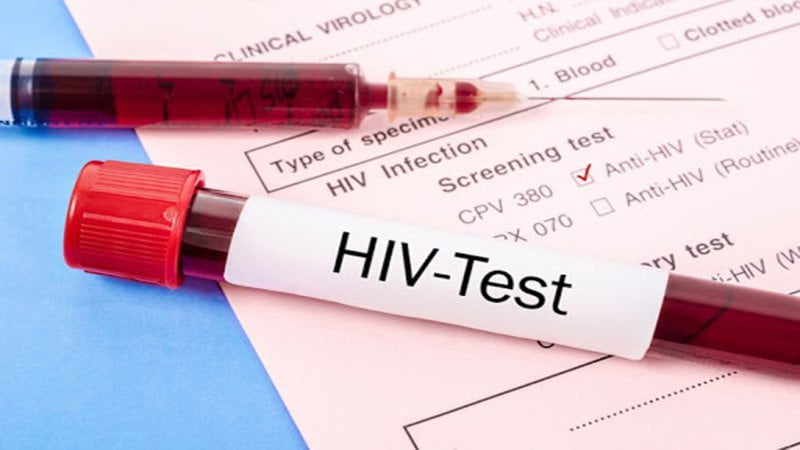 Xét nghiệm HIV là gì? các loại xét nghiệm HIV cần biết