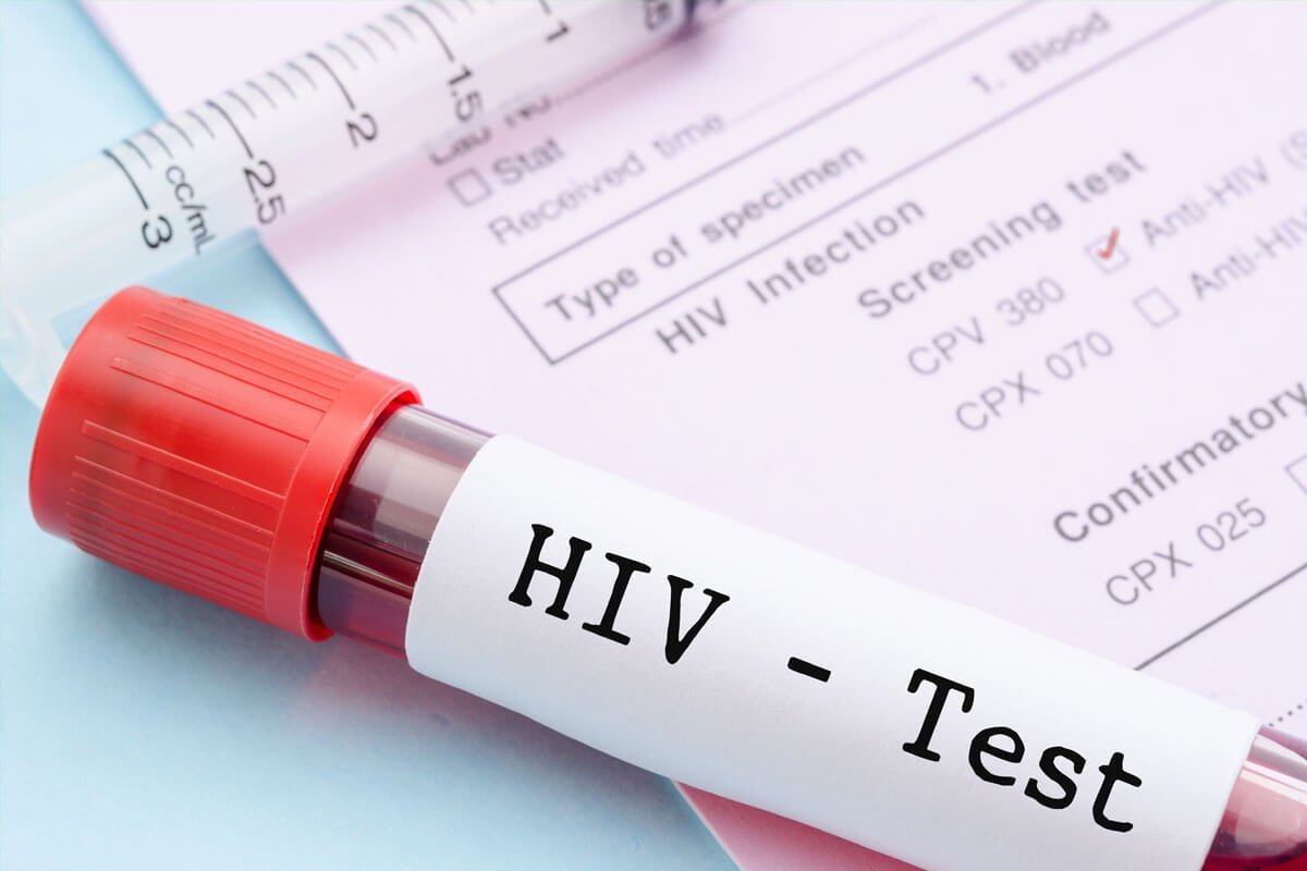 Xét nghiệm HIV COMBI PT là gì cách thực hiện xét nghiệm HIV COMBI PT