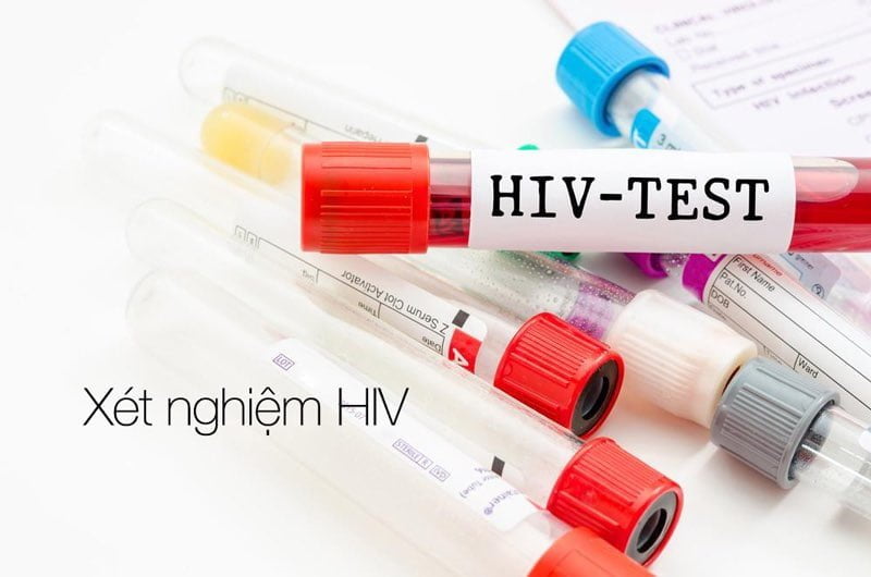 Các câu hỏi thường gặp khi tham gia xét nghiệm HIV