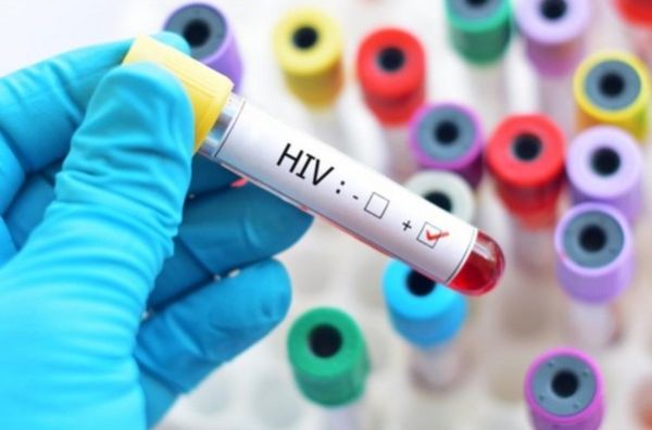 Những điều cần chuẩn bị trước khi xét nghiệm HIV