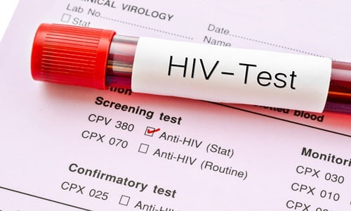 Xét nghiệm HIV trong khoảng thời gian nào là chính xác nhất ?