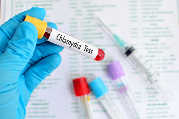 Đi xét nghiệm để xem bạn có bị nhiễm Chlamydia trachomatis hay không | G3VN