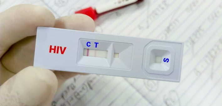 xét nghiệm HIV | Galant