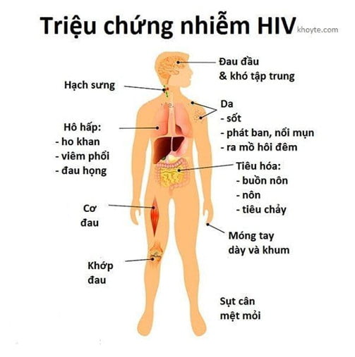 Dấu hiệu và cách nhận biết nhiễm HIV sớm | G3VN