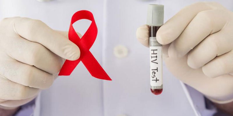 Xét nghiệm HIV chính xác nhất vào khoảng thời gian nào | G3VN