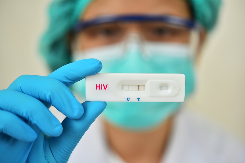 Xét nghiệm nước tiểu có phát hiện hiv không