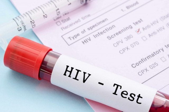 Các mốc phát triển và lây nhiễm HIV | G3VN