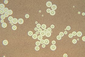 Viêm màng não do Cryptococcus | G3VN