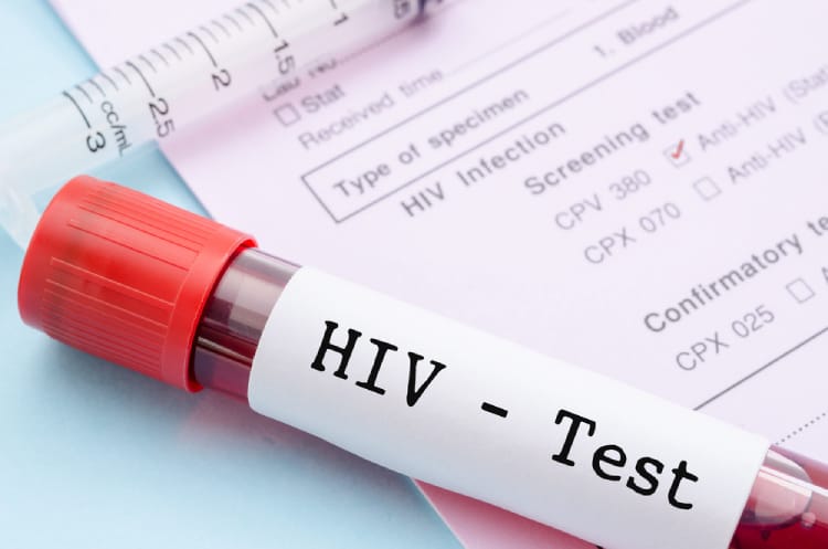 HIV lây truyền qua đường máu | G3VN