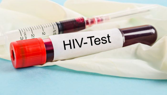 Trước khi thực hiện xét nghiệm HIV có cần phải nhịn ăn không | G3VN