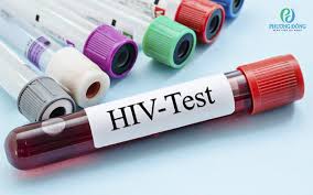 Xét nghiệm máu định kỳ có phát hiện được HIV không?