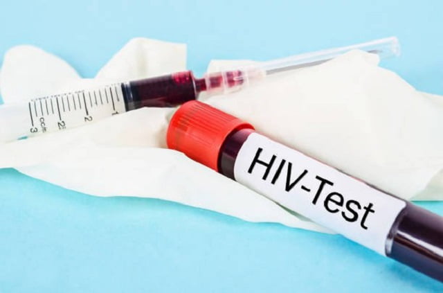 Khi nào cần xét nghiệm HIV? | G3VN