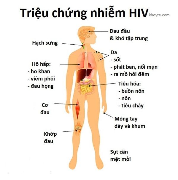 Các dấu hiệu của người bị nhiễm HIV