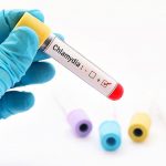 Xét nghiệm Chlamydia