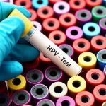 Xét nghiệm HPV
