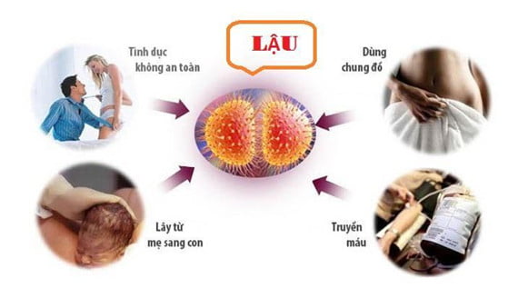 Nguyên nhân do lây truyền từ mẹ sang con