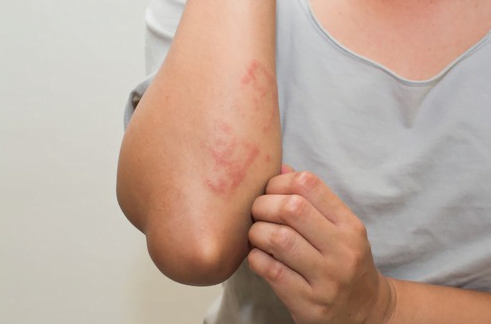 Giai đoạn có các triệu chứng nhẹ | G3VN