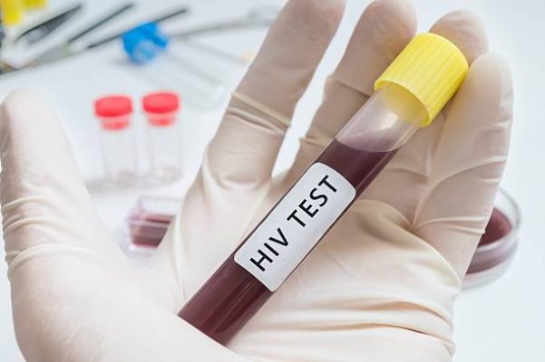 Các mốc phát triển và lây nhiễm HIV