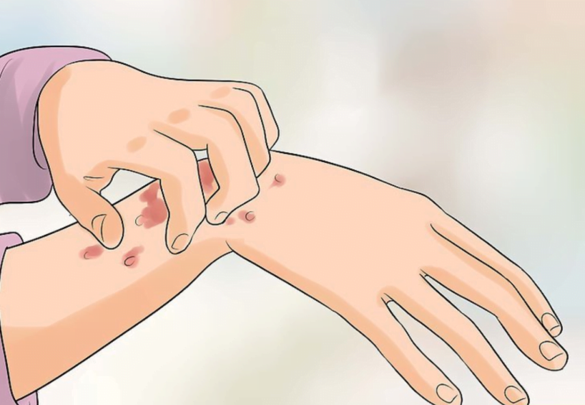 Xét nghiệm HIV trong khoảng thời gian nào là chính xác nhất ?