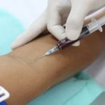Xét nghiệm giang mai là cách nhanh nhất để phát hiện bệnh giang mai