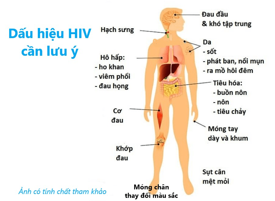 Bệnh lý HIV theo từng giai đoạn
