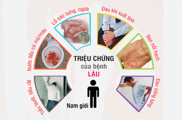 Biểu hiện bệnh lậu ở nam giới