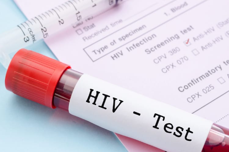 Những cách phòng tránh HIV bạn có thể áp dụng ngay